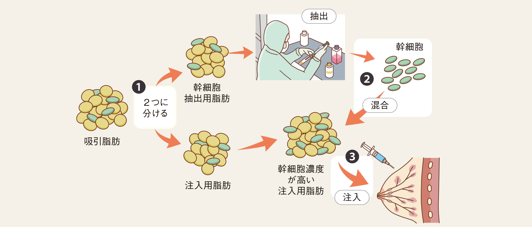 再生医療技術「CAL」について